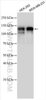 MAP7D1 Antibody in Western Blot (WB)
