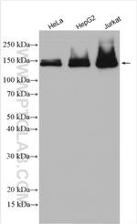 FANCI Antibody in Western Blot (WB)