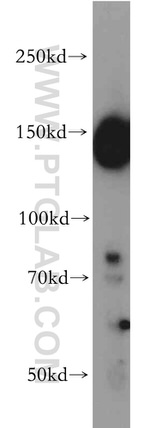 FANCI Antibody in Western Blot (WB)
