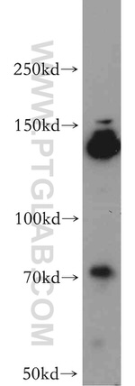 FANCI Antibody in Western Blot (WB)