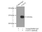 FANCI Antibody in Immunoprecipitation (IP)