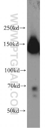 FANCI Antibody in Western Blot (WB)