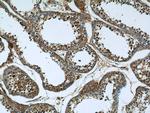 KIFC1 Antibody in Immunohistochemistry (Paraffin) (IHC (P))