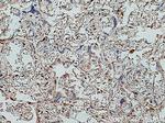 KIFC1 Antibody in Immunohistochemistry (Paraffin) (IHC (P))