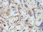 KIFC1 Antibody in Immunohistochemistry (Paraffin) (IHC (P))