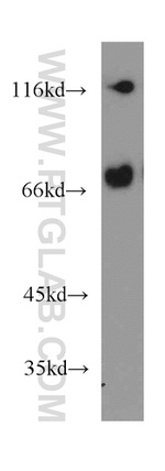 KIFC1 Antibody in Western Blot (WB)