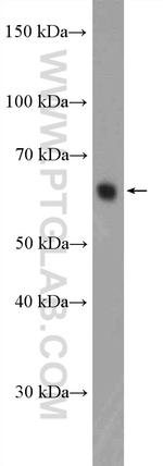 KIFC1 Antibody in Western Blot (WB)