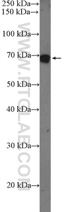 KIFC1 Antibody in Western Blot (WB)