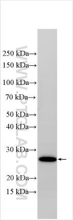 GPR172B Antibody in Western Blot (WB)