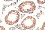 RNF133 Antibody in Immunohistochemistry (Paraffin) (IHC (P))