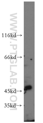 RNF133 Antibody in Western Blot (WB)