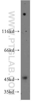 RNF133 Antibody in Western Blot (WB)