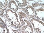 ZNF346 Antibody in Immunohistochemistry (Paraffin) (IHC (P))