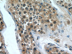 ZNF346 Antibody in Immunohistochemistry (Paraffin) (IHC (P))
