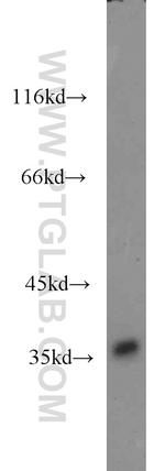 ZNF346 Antibody in Western Blot (WB)
