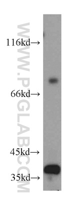 ZNF346 Antibody in Western Blot (WB)