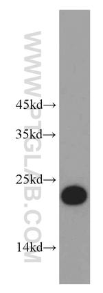 C7orf50 Antibody in Western Blot (WB)