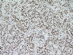 NUP50 Antibody in Immunohistochemistry (Paraffin) (IHC (P))