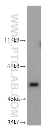 NUP50 Antibody in Western Blot (WB)