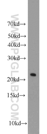 C16orf13 Antibody in Western Blot (WB)