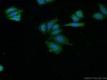 C16orf13 Antibody in Immunocytochemistry (ICC/IF)