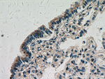 ZNF622 Antibody in Immunohistochemistry (Paraffin) (IHC (P))