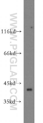 ZNF385D Antibody in Western Blot (WB)