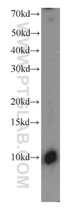 C16orf14 Antibody in Western Blot (WB)