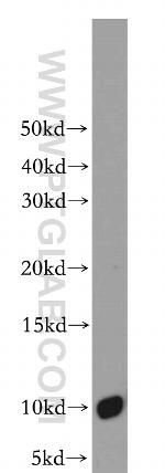 C16orf14 Antibody in Western Blot (WB)