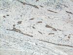 MT2A Antibody in Immunohistochemistry (Paraffin) (IHC (P))