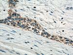 MT2A Antibody in Immunohistochemistry (Paraffin) (IHC (P))