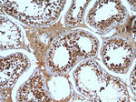 KDM1 Antibody in Immunohistochemistry (Paraffin) (IHC (P))