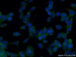 SHD Antibody in Immunocytochemistry (ICC/IF)