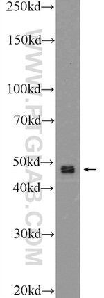 SHD Antibody in Western Blot (WB)
