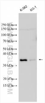 PTDSS1 Antibody in Western Blot (WB)