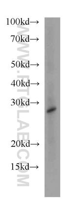 HDHD3 Antibody in Western Blot (WB)
