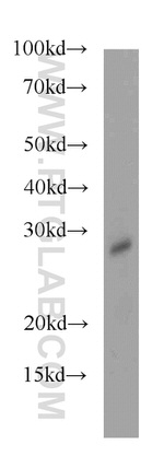 HDHD3 Antibody in Western Blot (WB)