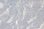 GALNT10 Antibody in Immunohistochemistry (Paraffin) (IHC (P))