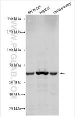 GALNT10 Antibody in Western Blot (WB)