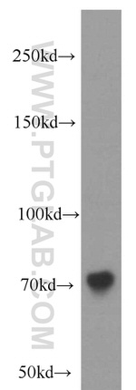 SGSM3 Antibody in Western Blot (WB)