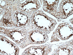 GLIPR1L1 Antibody in Immunohistochemistry (Paraffin) (IHC (P))