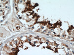 GLIPR1L1 Antibody in Immunohistochemistry (Paraffin) (IHC (P))