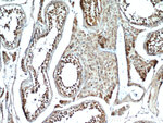 GLIPR1L1 Antibody in Immunohistochemistry (Paraffin) (IHC (P))