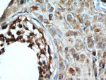 GLIPR1L1 Antibody in Immunohistochemistry (Paraffin) (IHC (P))