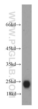 GLIPR1L1 Antibody in Western Blot (WB)