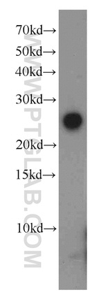 GLIPR1L1 Antibody in Western Blot (WB)
