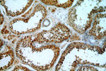 CCDC42 Antibody in Immunohistochemistry (Paraffin) (IHC (P))