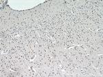 CCDC42 Antibody in Immunohistochemistry (Paraffin) (IHC (P))