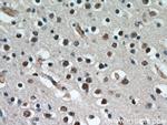 CCDC42 Antibody in Immunohistochemistry (Paraffin) (IHC (P))