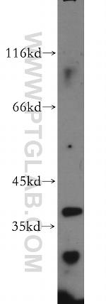 CCDC42 Antibody in Western Blot (WB)